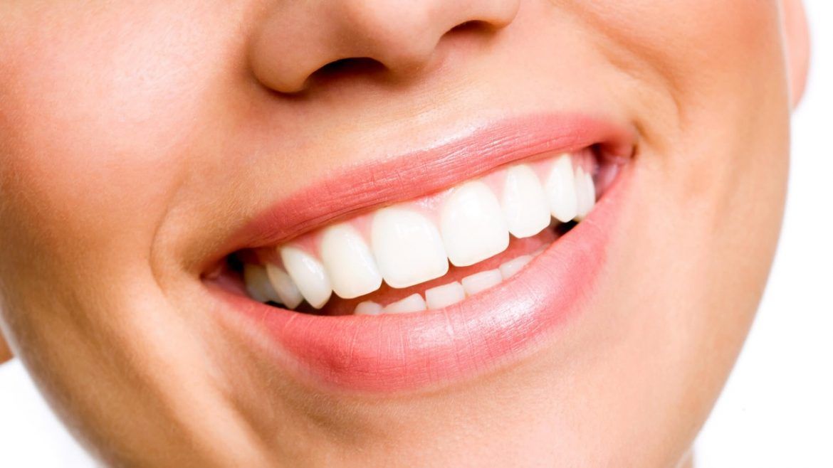 ¿Cómo lograr la sonrisa ideal? - Gastronomía y Moda