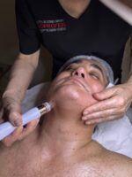 Este tratamiento facial enamorará a tu piel - Gastronomía y Moda