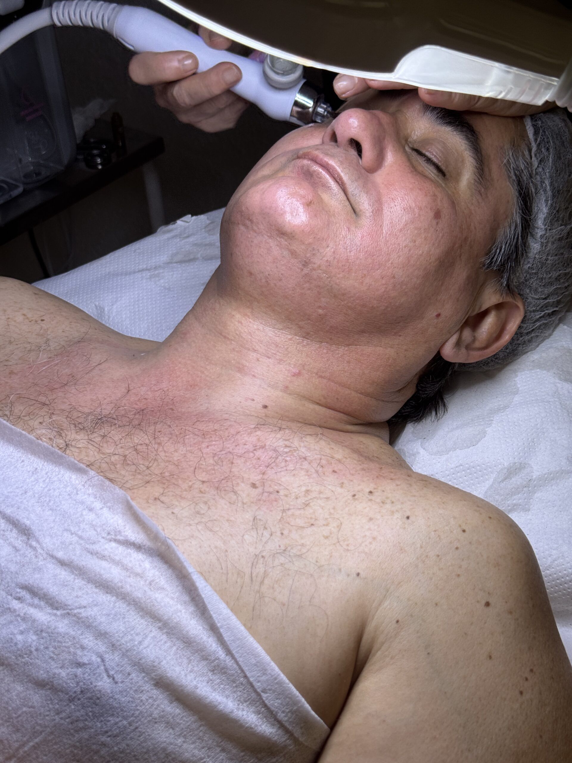 Este tratamiento facial enamorará a tu piel - Gastronomía y Moda